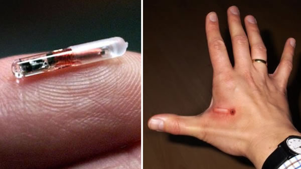 O chip será inserido entre o dedo indicador da mão e o dedão. Foto: Reprodução