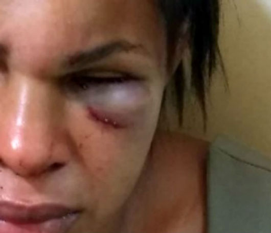 Mulher é atacada a socos e pontapés pelo marido na cidade de Ubatã, na Bahia (Foto: Ubatã Notícias