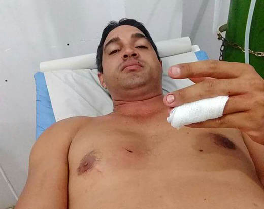 Comerciante foi atingido por golpes de faca em um dos dedos da mão e no peito | Foto: Notícias de Santaluz