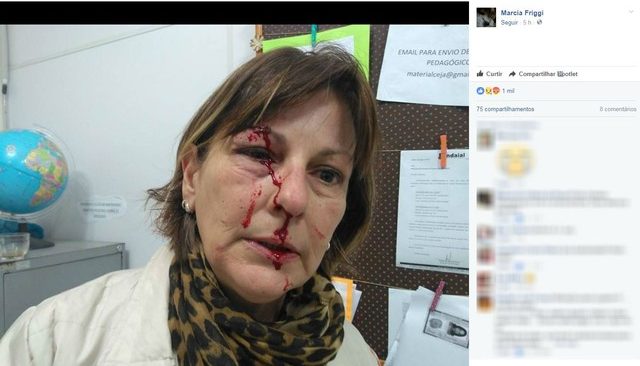 Professora postou fotos da agressão no Facebook (Foto: Reprodução/Facebook