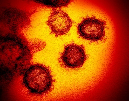 Imagem de microscópico mostra o novo coronavírus, responsável pela doença chamada Covid-19 | Foto: NIAID-RML/AP