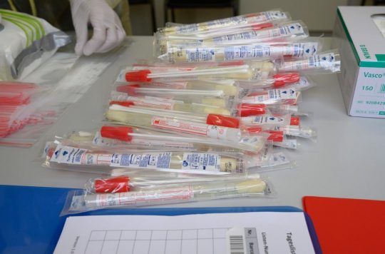 Coronavírus é detectado por meio de testes — Foto: Thomas Kienzle / AFP